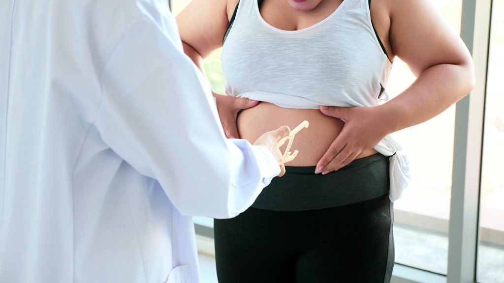 Chubby woman touching belly at the hospital room.