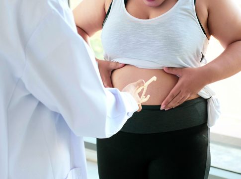Chubby woman touching belly at the hospital room.