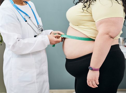 Obesity, unhealthy weight. Nutritionist inspecting a woman's waist using a meter tape to prescribe a weight loss diet