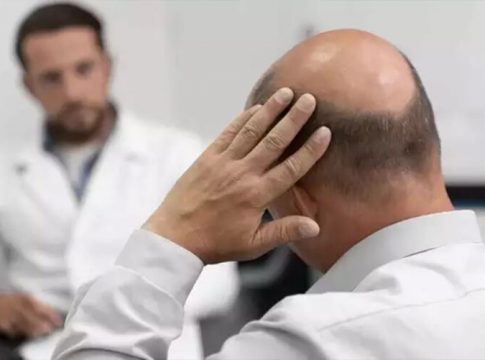 Entenda o uso do minoxidil, remédio que faz crescer cabelo
