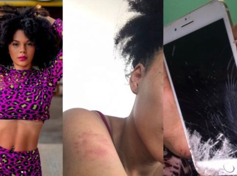 Modelo é agredida por ex-companheiro em Castanhal