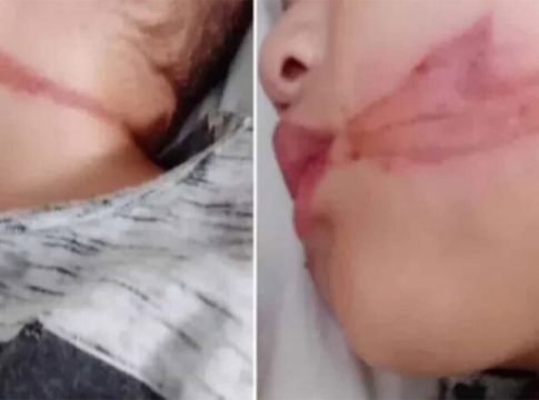 Bebês são "chicoteados" por fiação solta no interior de SP