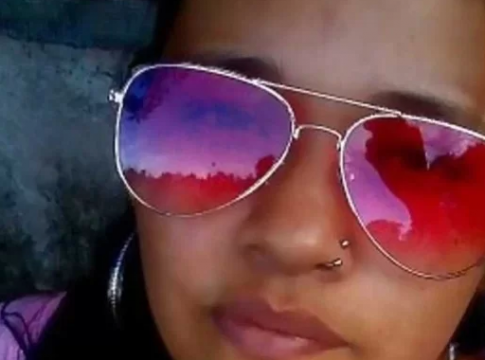 Mulher sai de coma, acusa marido de queimá-la e morre
