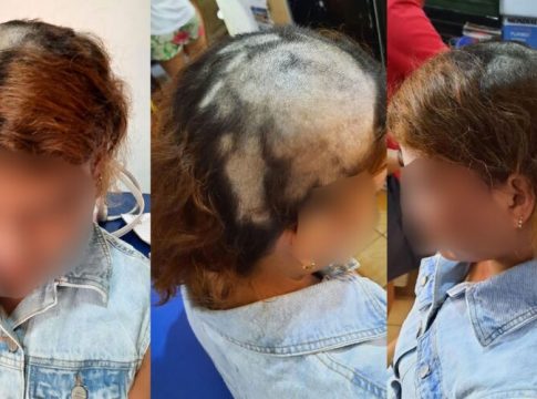 Vitima de sequestro que teve cabeça raspada acusa ex-patroa 