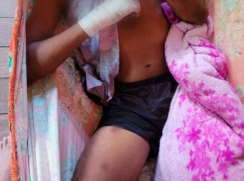 Vídeo: adolescente é atacado por onça no Marajó