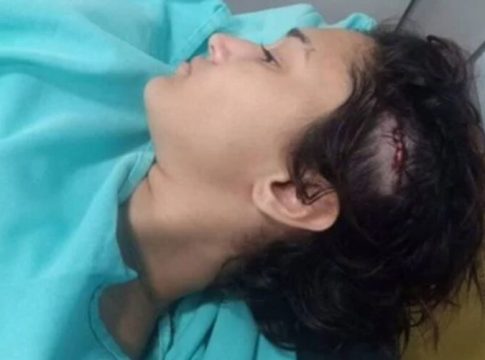 Jovem é agredida com paulada após criticar Bolsonaro em bar