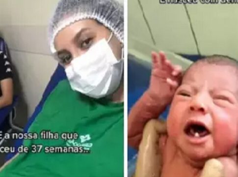 Caso raro: bebê nasce com dentes em hospital de Ananindeua 