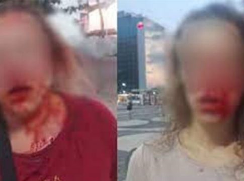 Turistas da Europa são espancadas durante assalto no Rio