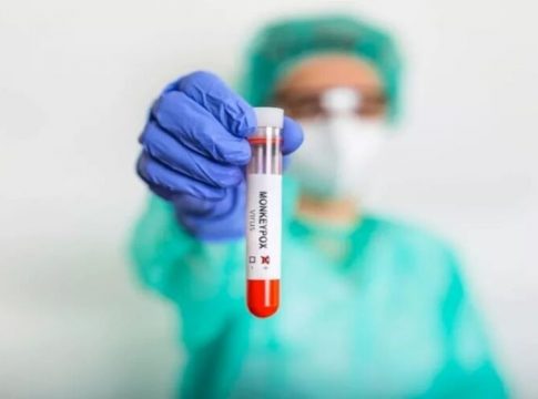 Casos confirmados de varíola dos macacos chegam a 29 no Pará
