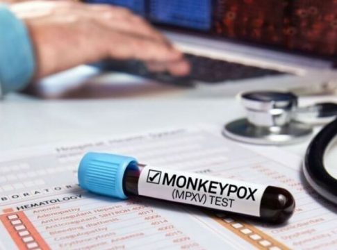De acordo com a Secretaria de Saúde (Sespa), há 112 casos confirmados de Monkeypox no Pará. A capital concentra mais casos confirmados. Foto: Divulgação