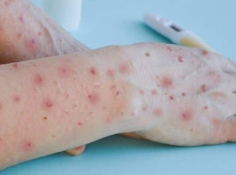 Na última semana, eram 13 confirmações de pacientes infectados. Foto: Divulgação