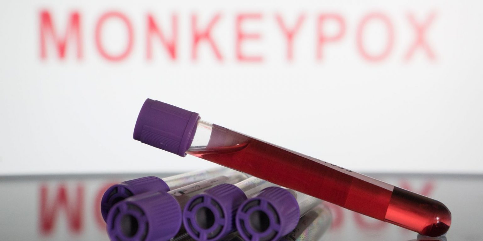 O Pará confirmou até agora 56 casos de monkeypox. Foto: Divulgação O Pará confirmou até agora 56 casos de monkeypox. Foto: Divulgação