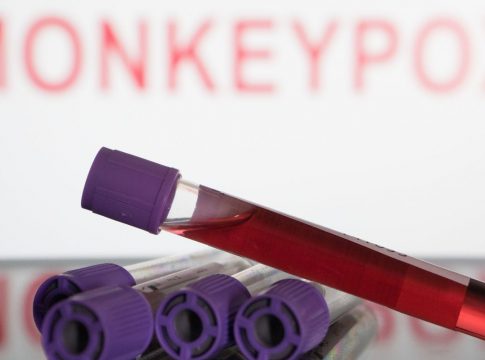O Pará confirmou até agora 56 casos de monkeypox. Foto: Divulgação