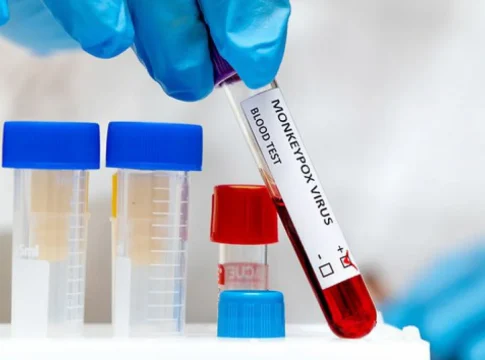 Ao todo, 31 laboratórios de referência fazem o diagnóstico da doença no País. Foto: Divulgação
