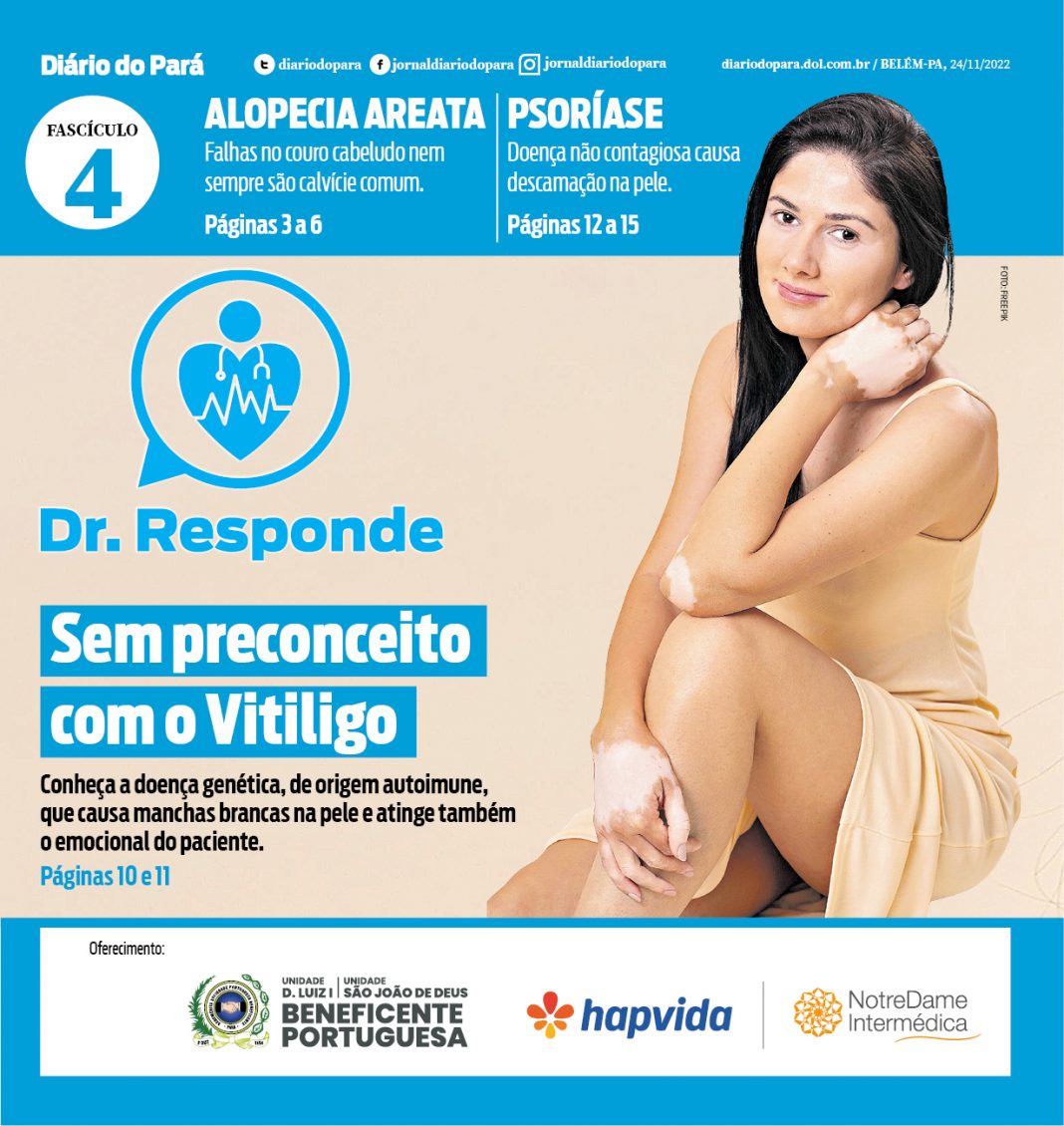 'DR. RESPONDE': Tire suas dúvidas sobre Vitiligo, Alopecia e Psoríase