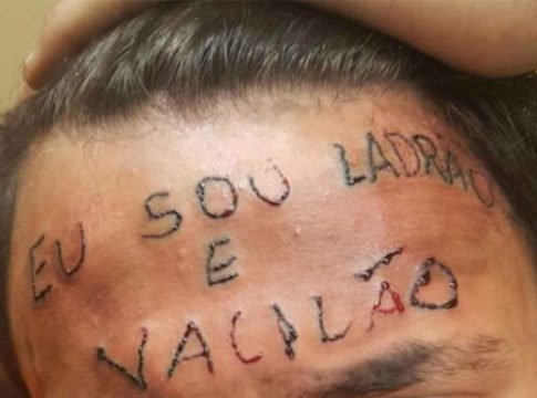 Silva, que atualmente tem 22 anos, foi torturado e teve a testa tatuada em julho de 2017 após entrar em um imóvel e ser acusado de furtar uma bicicleta. Foto: Divulgação