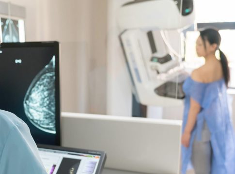 No Brasil, mais de 73,6 mil novos casos de câncer de mama são diagnosticados por ano. Foto: Divulgação