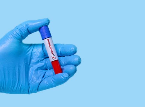 A OMS (Organização Mundial da Saúde) alertou, nesta quinta-feira (15), que novos casos de Mpox podem surgir na Europa