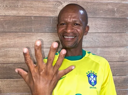 Baiano de seis dedos já se considera hexa e ficou 'aliviado' com 7 a 1. Foto: Divulgação