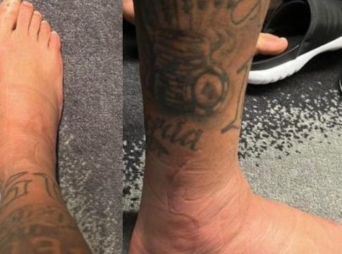 O atacante do Brasil postou quatro fotos, duas delas do tornozelo lesionado. Foto: Divulgação