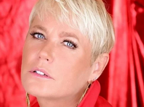 Xuxa Meneghel passou por um procedimento estético no Hospital Albert Einstein, São Paulo, neste final de semana. Foto: Divulgação