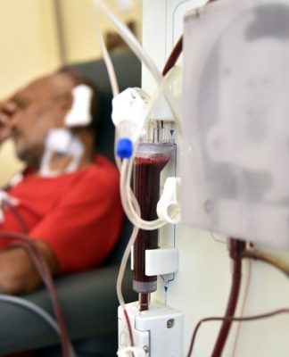 Principal tratamento para a doença na fase crônica é a hemodiálise, oferecida pelo SUS

FOTO: PILLAR PEDREIRA/AGÊNCIA SENADO