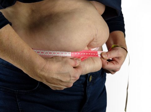 De acordo com a Organização Mundial da Saúde (OMS), mais de 1 bilhão de pessoas no mundo são consideradas obesas. Foto: Pixabay